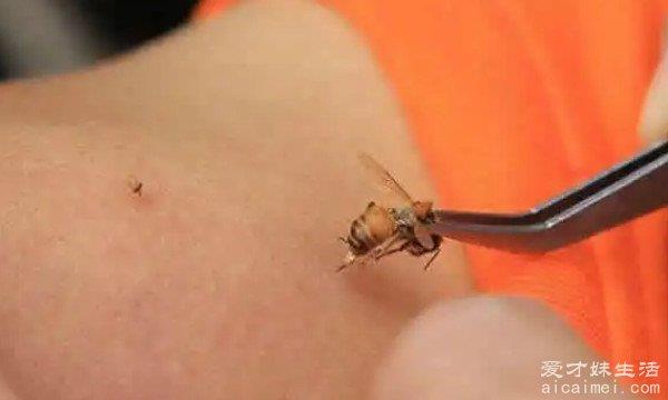 被蜜蜂蛰了怎么消肿止痒的最快方法 3种方法(用肥皂清洗)