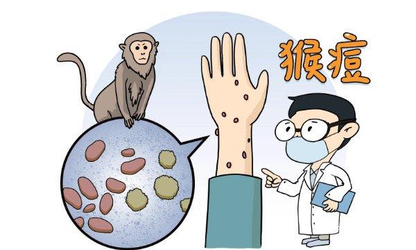 猴痘是什么病有什么症状 是DNA双链病毒(出现头痛/发热)