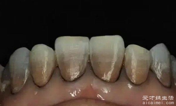 暗示老人阳寿将尽的9个症状，看看你中了几个？
